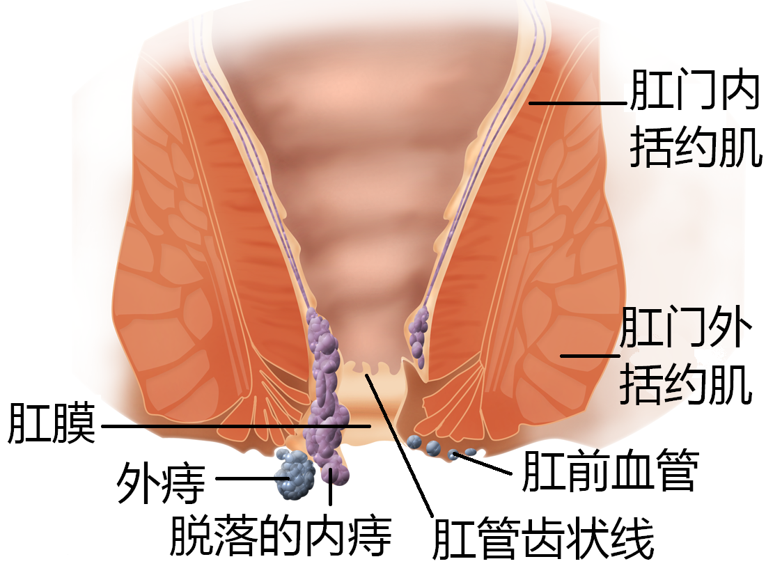 科学|印度人很少得痔疮，是真的吗？