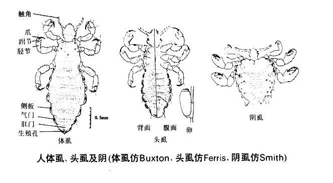 跳蚤|过去农村几乎人人都有虱子，现在怎么没有了？虱子是哪里来的？