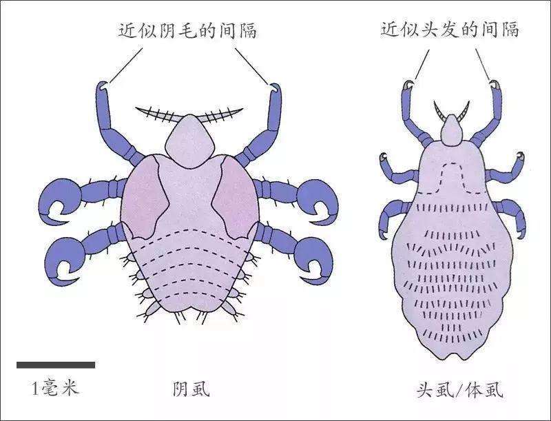 跳蚤|过去农村几乎人人都有虱子，现在怎么没有了？虱子是哪里来的？