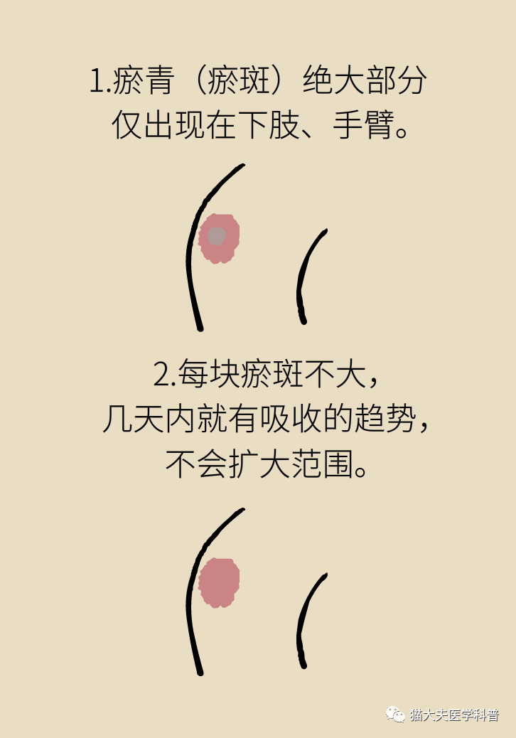 健康|一碰就青、手脚冰凉、爱出汗，这3种体质是病吗？