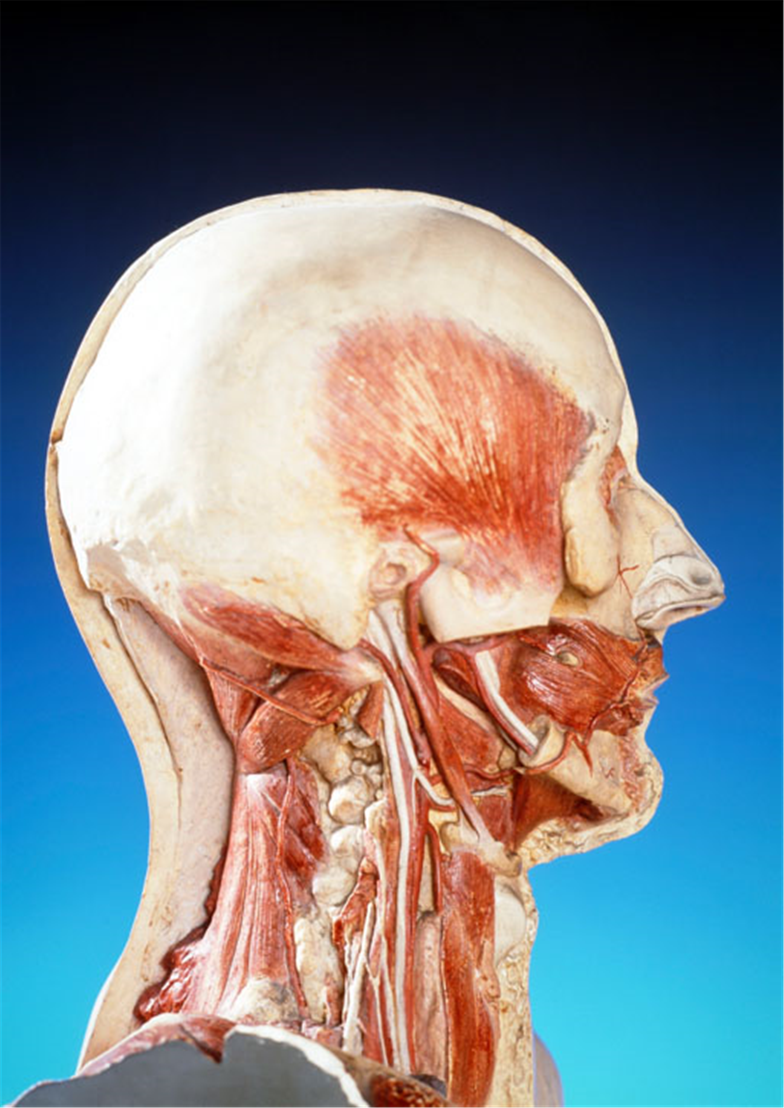 甲状腺|如果心脏上有了这个“桥”，千万莫激动！