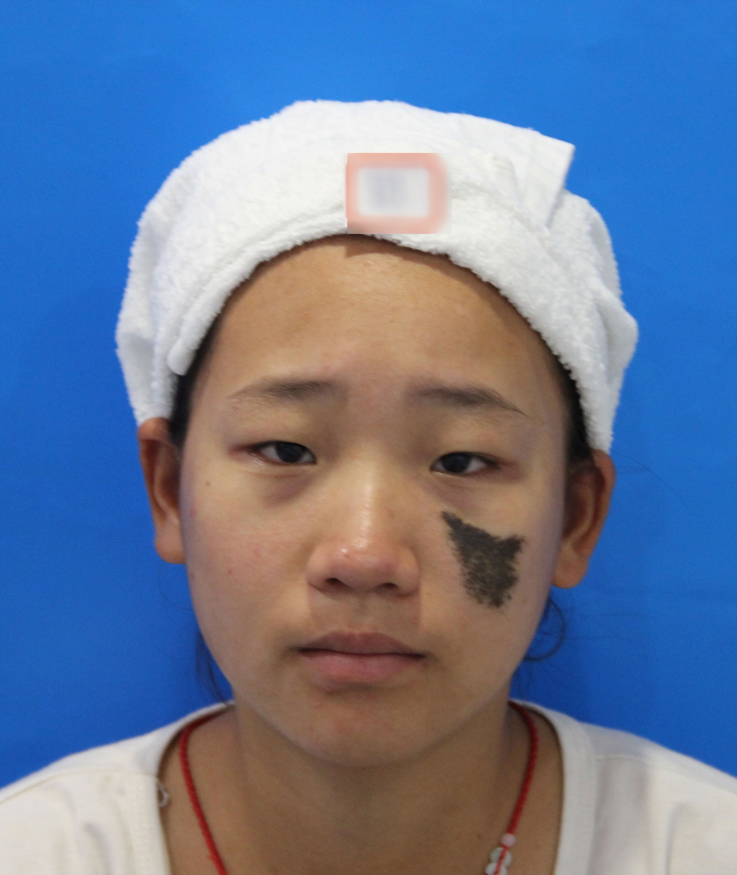 智商税|医美火爆的背后危险重重，医美也有智商税！