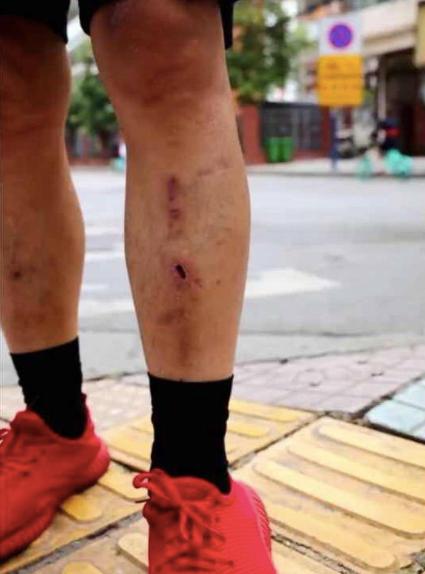 社会|这1700万人仅仅是活着，就已经拼尽了全力