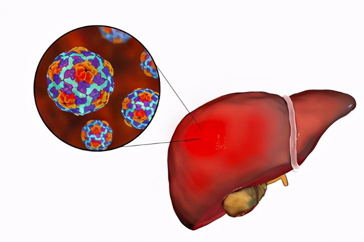 丙肝|2020诺奖解读｜生理学或医学奖为何颁给丙肝病毒发现者？