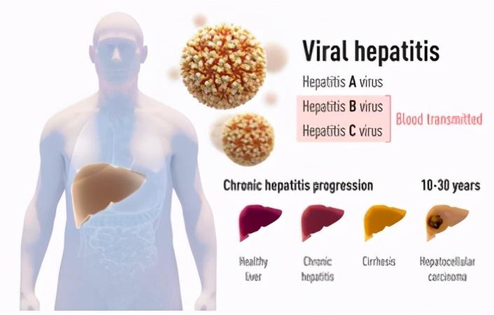 丙肝|2020诺奖解读｜生理学或医学奖为何颁给丙肝病毒发现者？