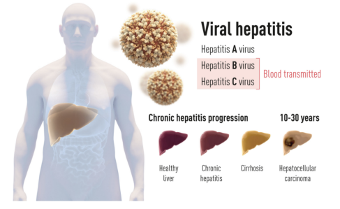 丙肝|他们发现了丙肝病毒！三位科学家荣获2020年诺贝尔生理学或医学奖