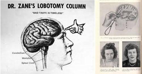 诺贝尔|1949年诺贝尔医学奖，为什么成了30万人永无休止的噩梦？