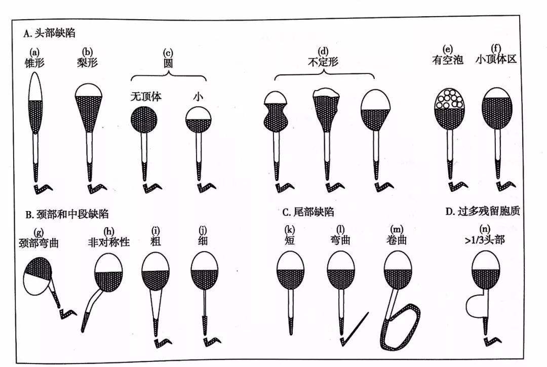 畸形精子|精子是如何形成的？它会被用尽吗？