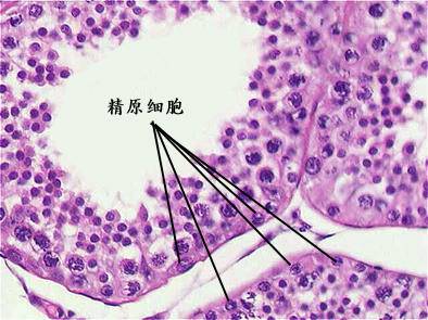 畸形精子|为什么游泳速度最快的精子，反而成了炮灰？