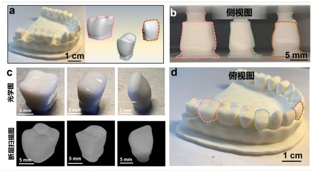 3d打印|神奇的3D打印教你，如何快速地将一滴墨水变成一颗牙齿