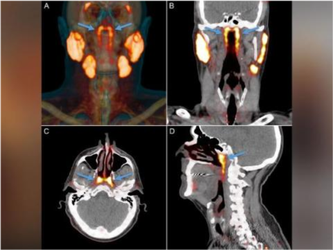 科学|荷兰科学家称或发现人类新器官：使用传统医学无法发现