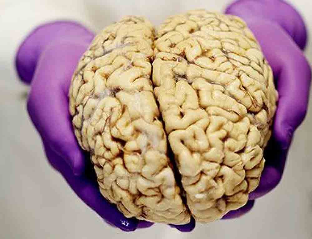 科学|大脑和意识不可分割吗？科学家复活猪大脑，意识是否也会恢复？