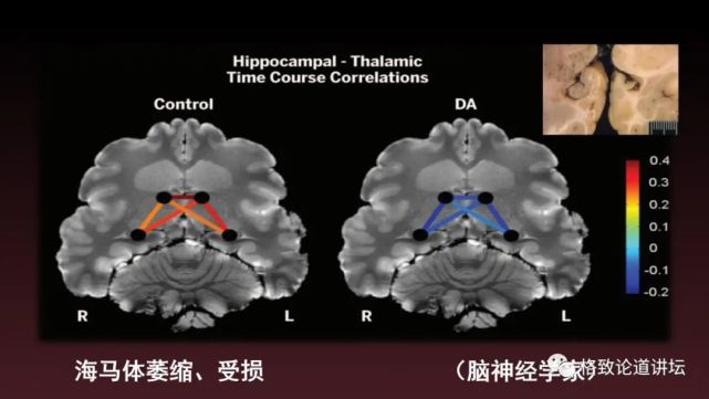 海狮|科学家用了17年，终于擒获杀害海狮的罪魁祸首