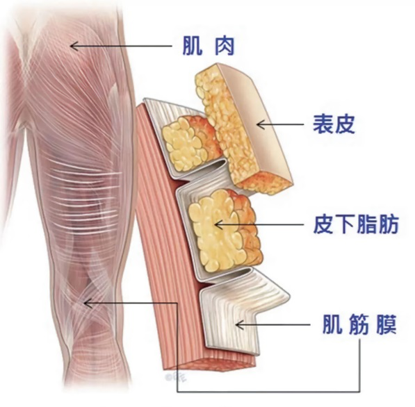 人体筋膜示意图 来源丨知乎