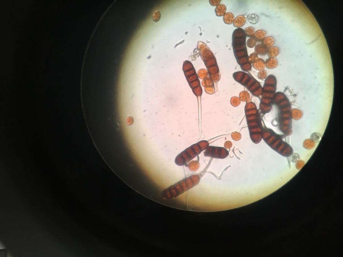 显微镜下的锈菌冬孢子和夏孢子｜来源：作者提供