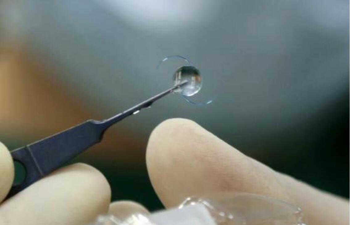国产人工角膜或于今年6月用于临床价格仅为进口十分之一