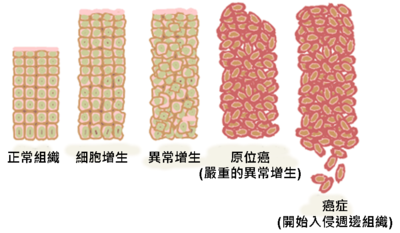 癌细胞|为什么不研制一款能预防癌症的疫苗？科学家：癌细胞是自己人叛变