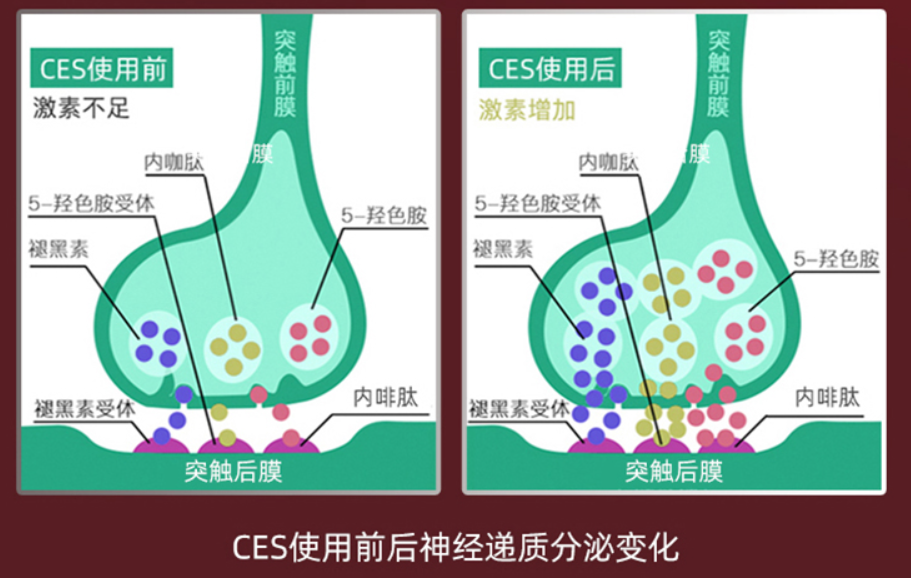 睡眠|网上卖的睡眠仪一握就睡，有效果吗？原理是什么？会不会损伤身体