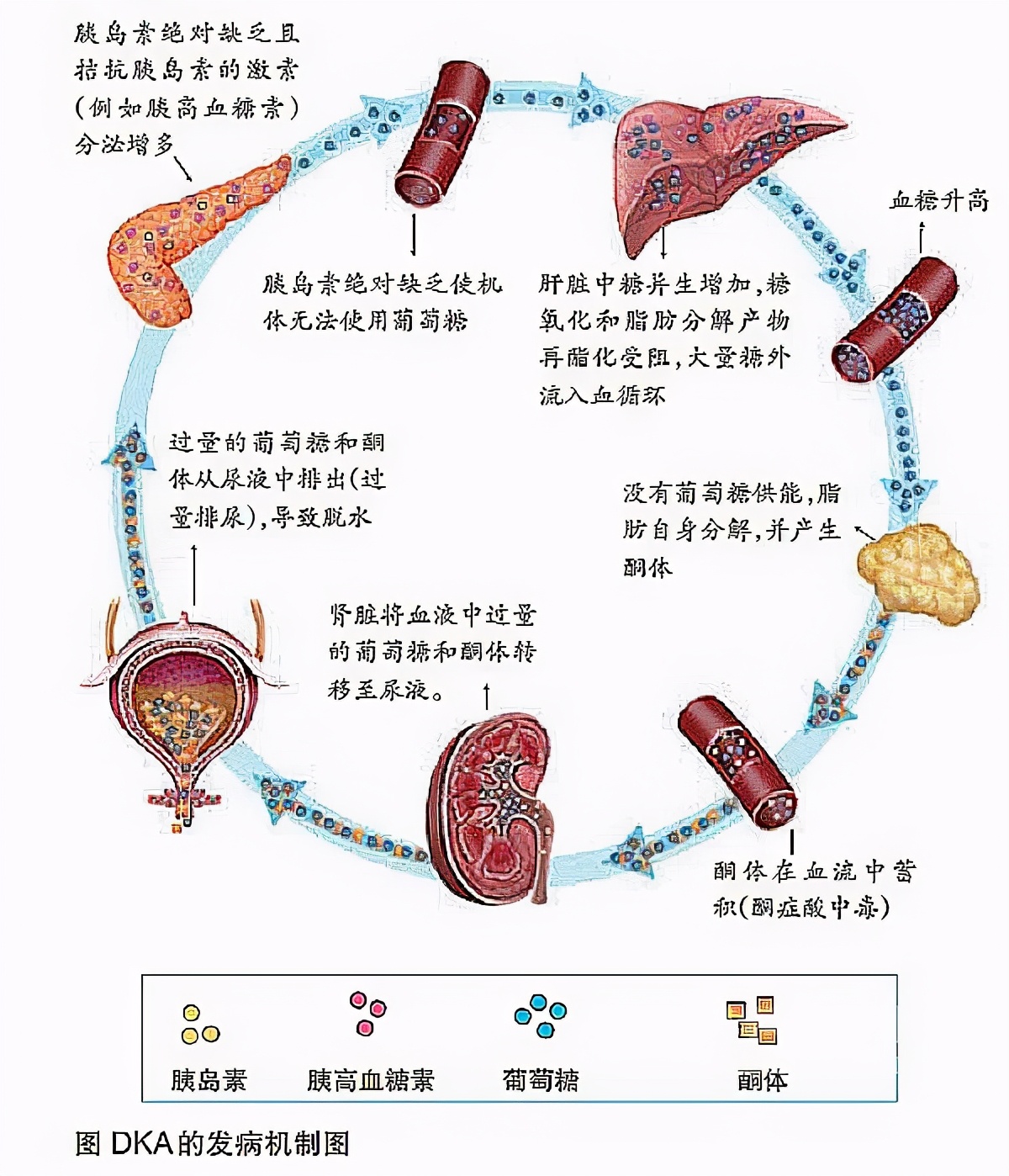 人体自燃|人体真的会自燃吗？研究发现“烛芯效应”让穿衣服的人燃烧得更快
