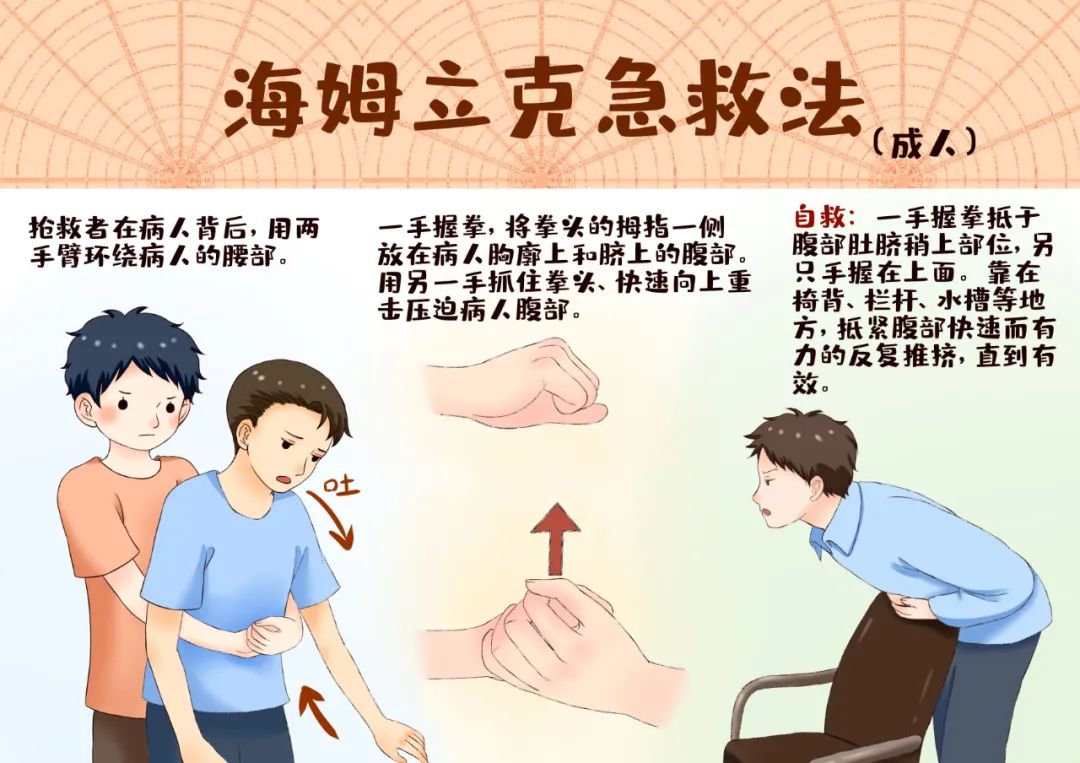急救常识幼儿园海姆立克法防溺水等急救常识集锦关键时刻可以救命家长