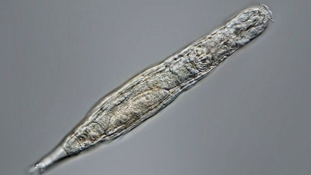 科学|北极永冻层中沉睡2.4万年，一种微生物被俄罗斯科学家“复活”