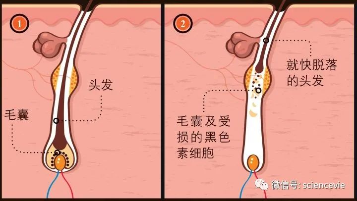 去甲肾上腺素|压力让人一夜白头，其实是一种进化痕迹