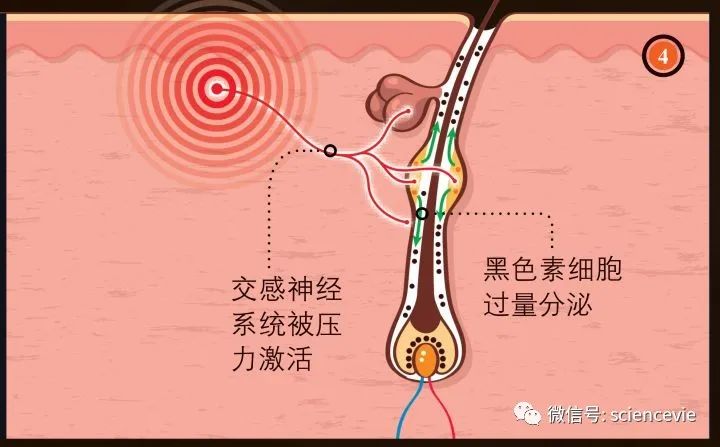 去甲肾上腺素|压力让人一夜白头，其实是一种进化痕迹