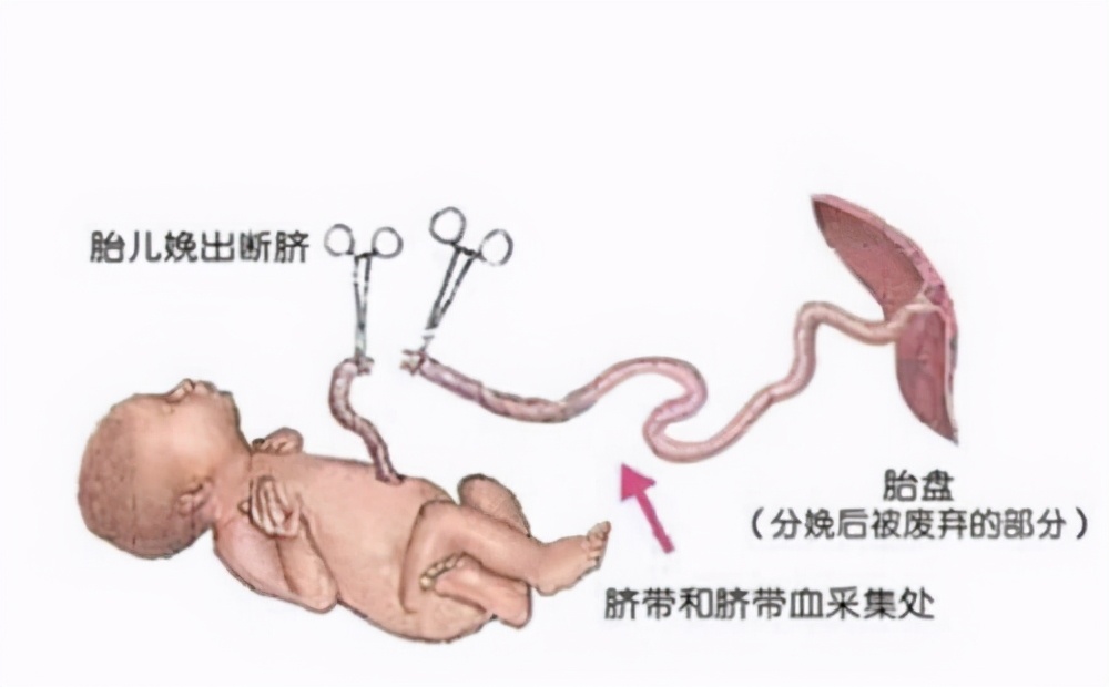 用工具刺穿肚脐进小肠图片