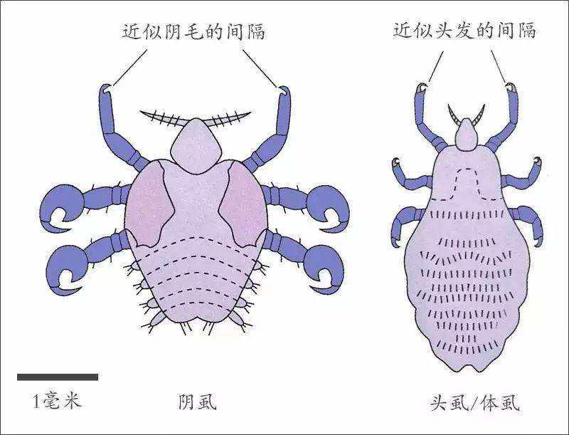 阴虱和头虱有什么区别图片