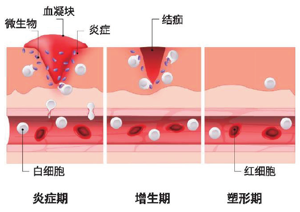 电子皮肤|藏文科普｜电子皮肤可自愈？甚至比人类皮肤更强大？