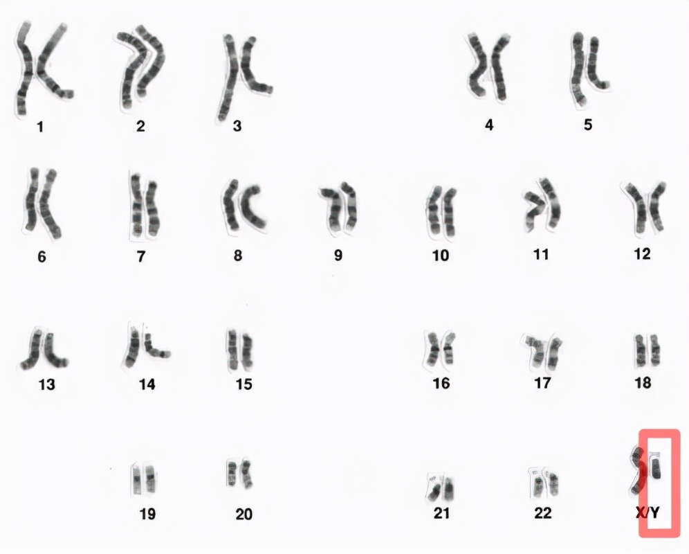 y染色体|6-9万年前，生活在非洲的一位男性，是现代所有男性的共同祖先