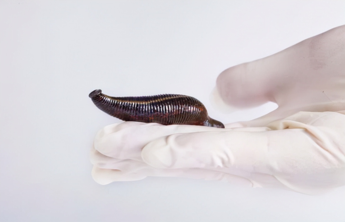 蚂蟥如果不小心被吃进肚子中它还会在人体内长期存活吗