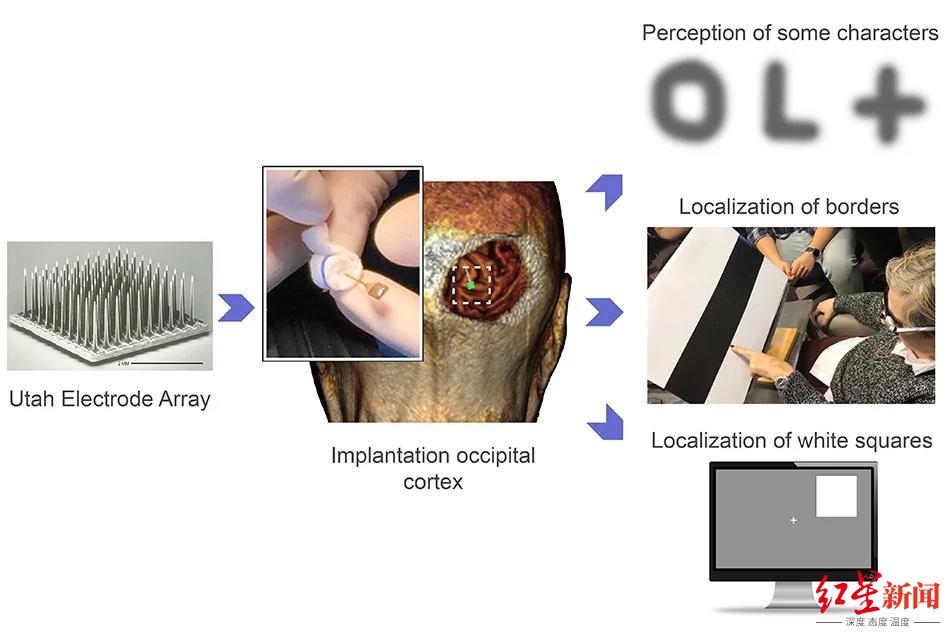 科技|让盲人不用眼睛也能重见光明，这套高科技设备做到了！