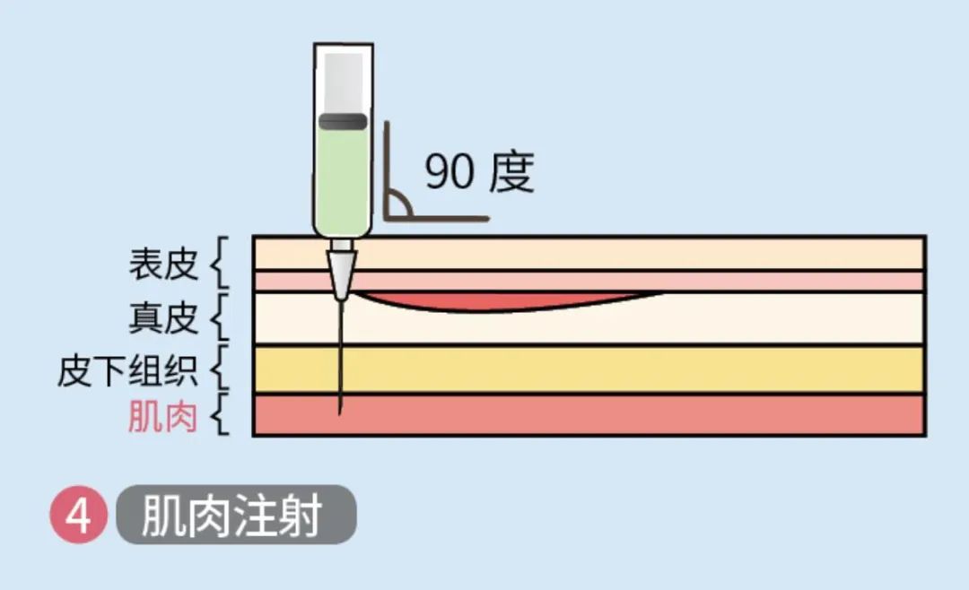 让打针几乎没有痛感儿童可以实现无针注射啦