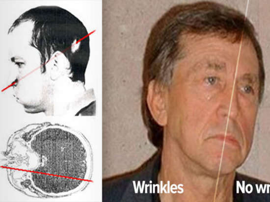 他遭受20万伦琴辐射理应当场死亡但几十年过去左脸依旧年轻