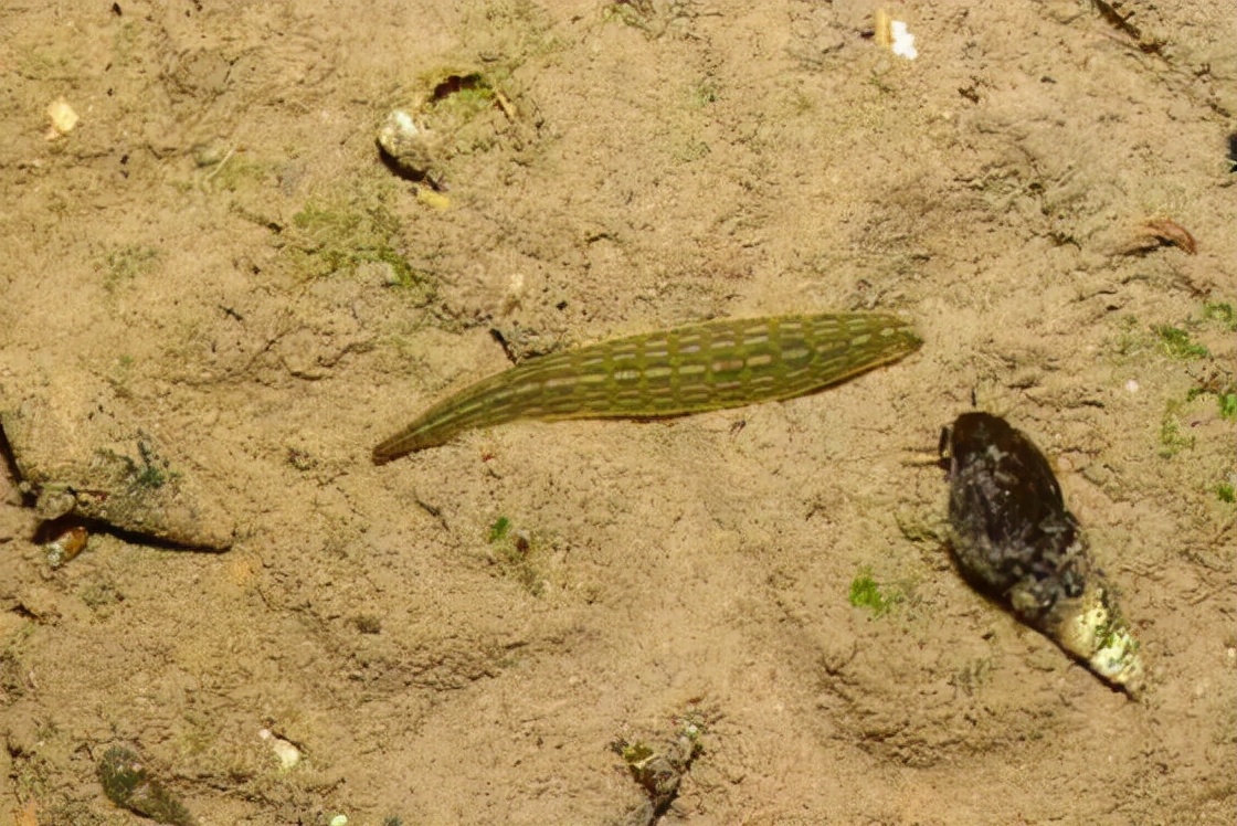 隐私部位也能寄生蚂蟥70岁妇女被蚂蟥寄生在宫颈口长期被吸血