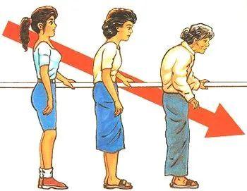 驼背可能缩短寿命3种方法自测是否驼背