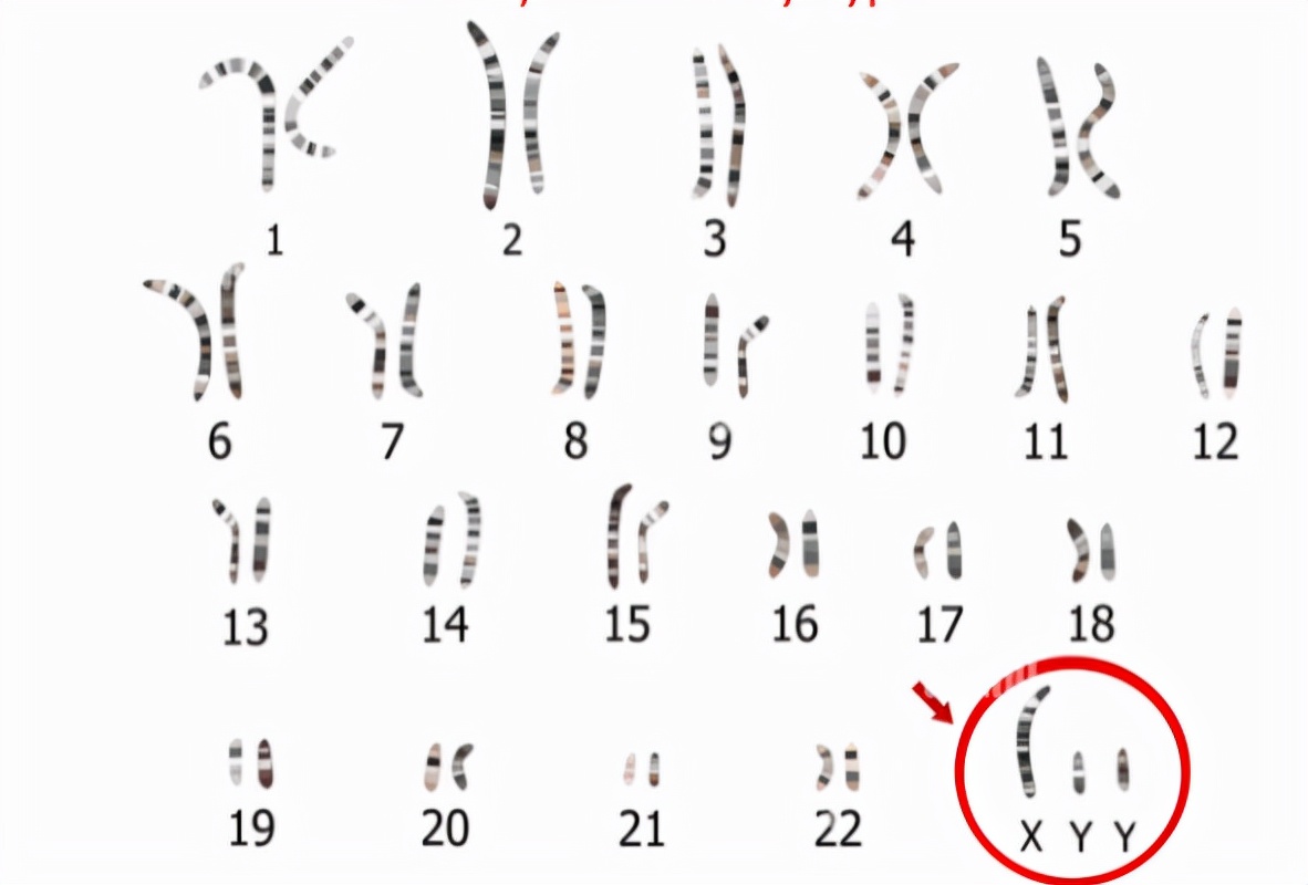 性染色体男女图片