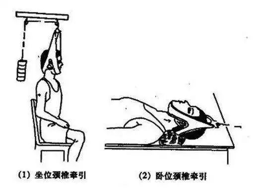 颈椎牵引角度图解图片