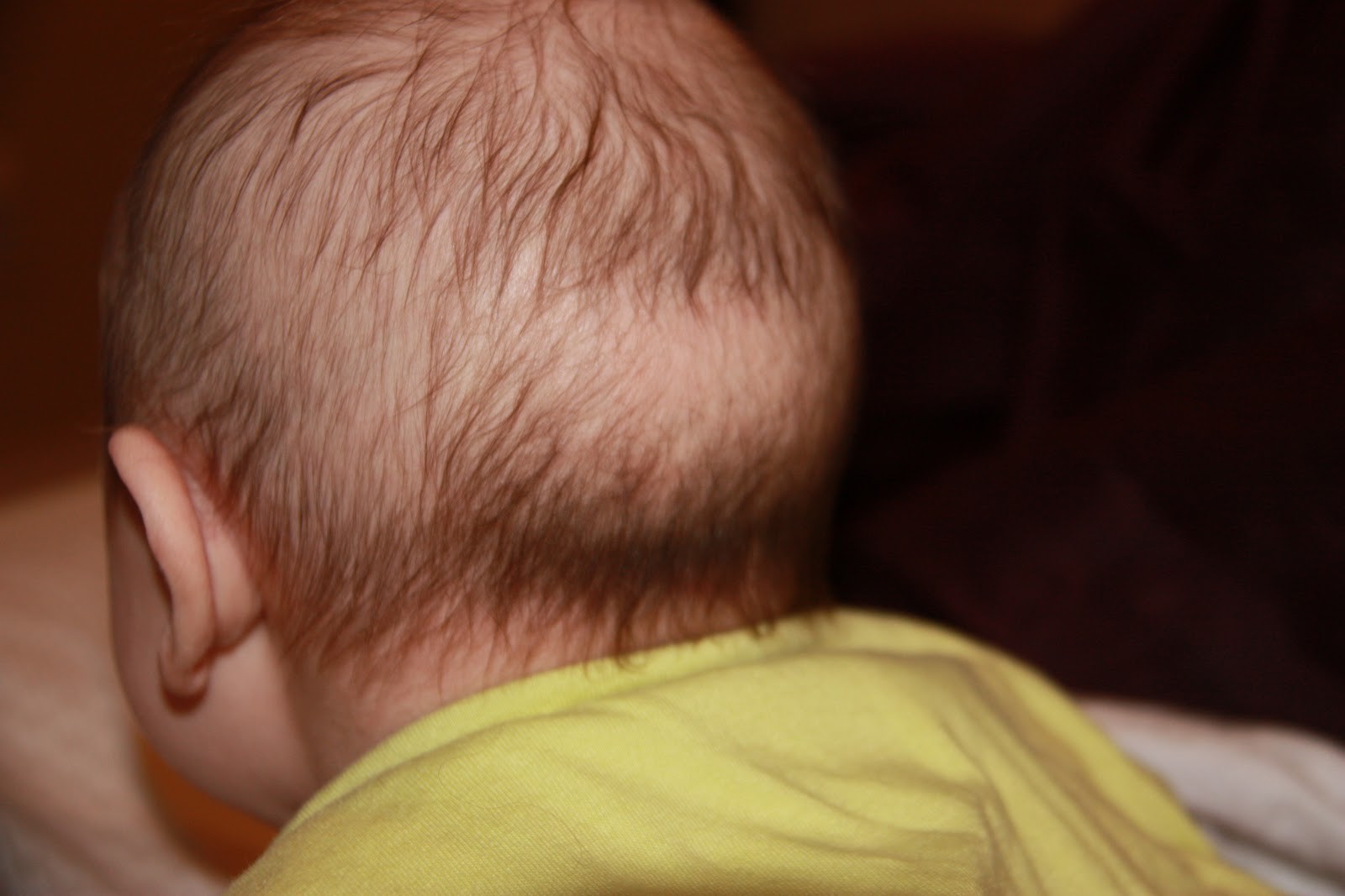 婴儿不长头发（8个月宝宝后脑勺没头发）-幼儿百科-魔术铺